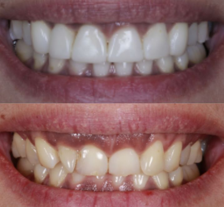 Smile Gallery