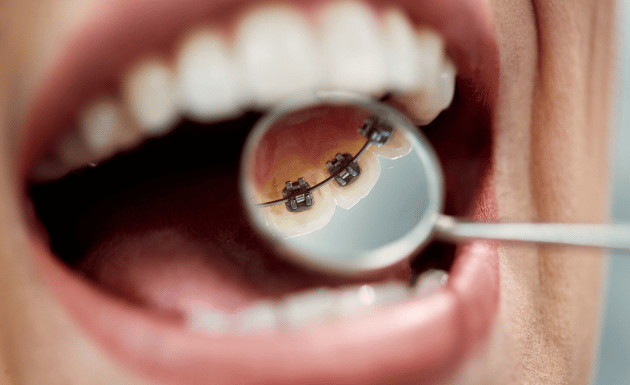 Treatment - Eastbury Dental Practice