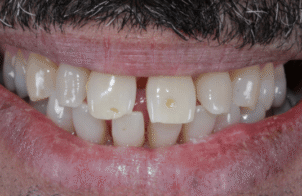 Before - Eastbury Dental Practice