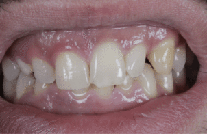 Before - Eastbury Dental Practice
