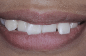 Before - Eastbury Dental Practice