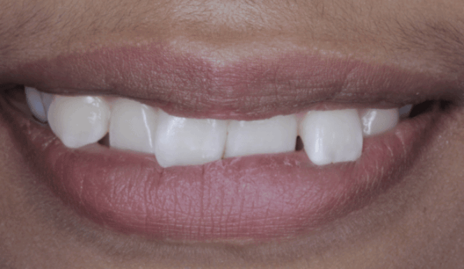 Before - Eastbury Dental Practice