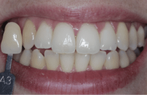Before - Eastbury Dental Practice