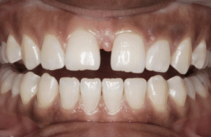 Before - Eastbury Dental Practice