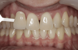Before - Eastbury Dental Practice
