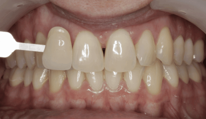 Before - Eastbury Dental Practice