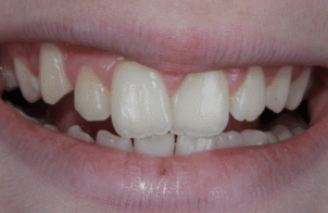 Before - Eastbury Dental Practice