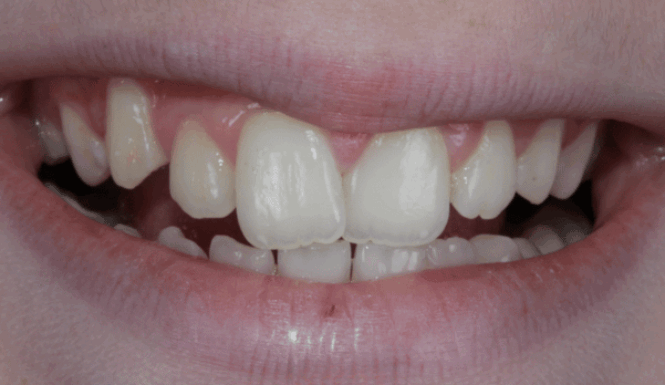 Before - Eastbury Dental Practice