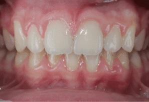 After - Eastbury Dental Practice