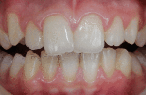 Before - Eastbury Dental Practice