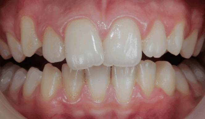 Before - Eastbury Dental Practice